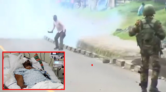 Man Who Confronted Police with Panga Found Brutally Injured After Alleged Abduction by State Agents.